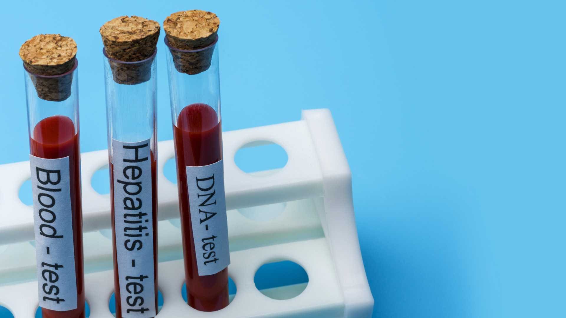 ما هو تحليل DNA